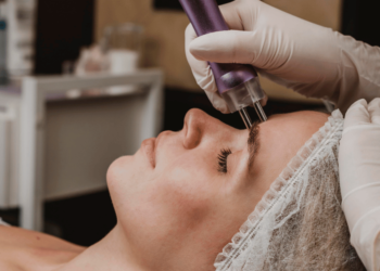 Microneedling: Het geheim voor een stralende, egale huid!